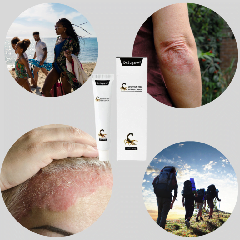 Skin Inflammation Relief Cream for Psoriasis, Eczema, and Dermatitis for everywhere you go