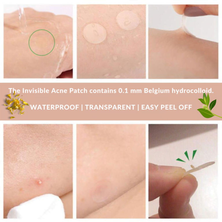 Invisible Acne Patch benefits
