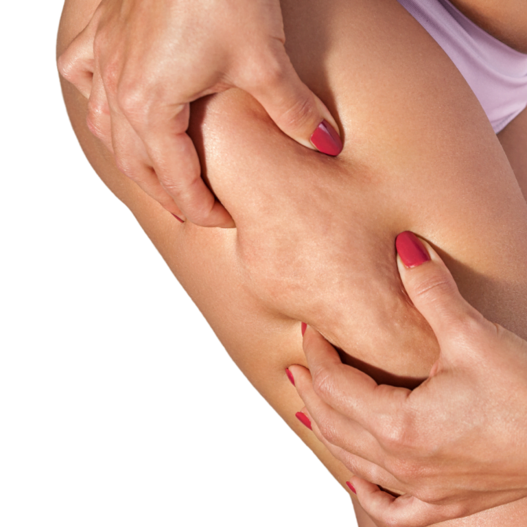 3 in 1 device for removing Cellulite