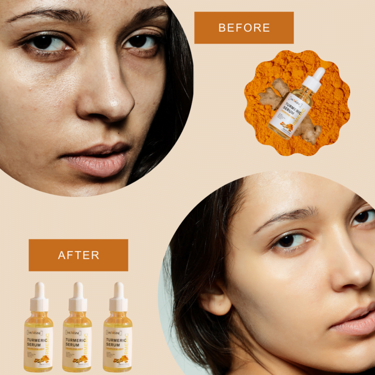 turmeric dark spot corrector serum before and after