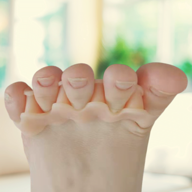 Bunion and Toe Corrector -one size fits all-prevent bunions-fix crooked toes