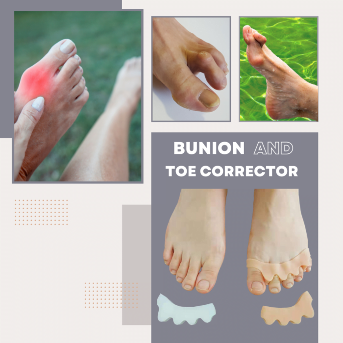Bunion and Toe Corrector for bunions, hammer toe, overlapping toes