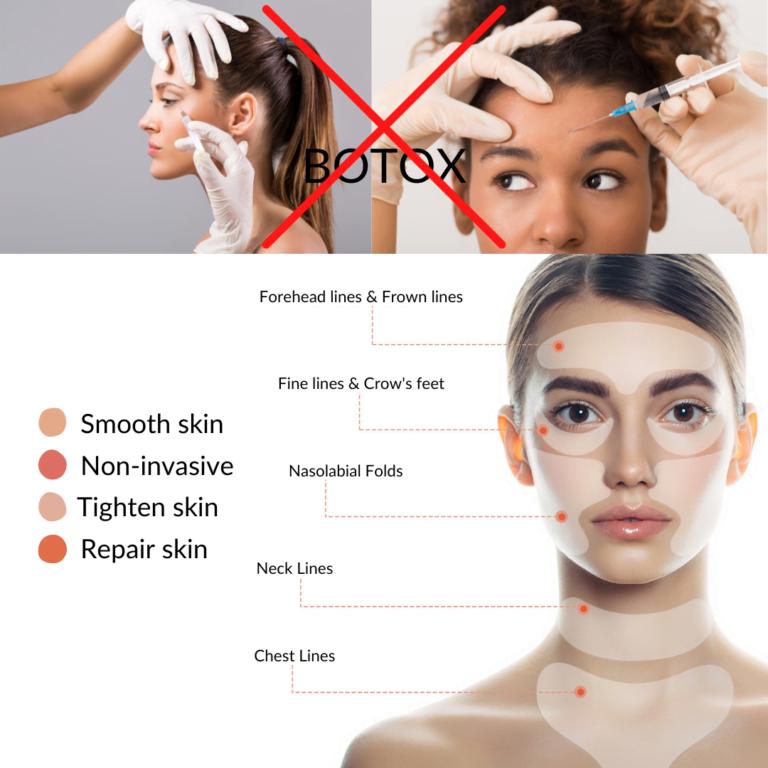 Instant Lift Anti-wrinkle Patches- No Botox required, suitable for the entire body
