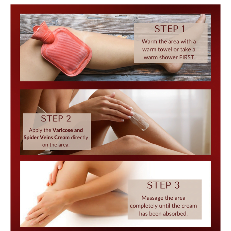 Varicose and Spider Veins Removal Cream-how to use