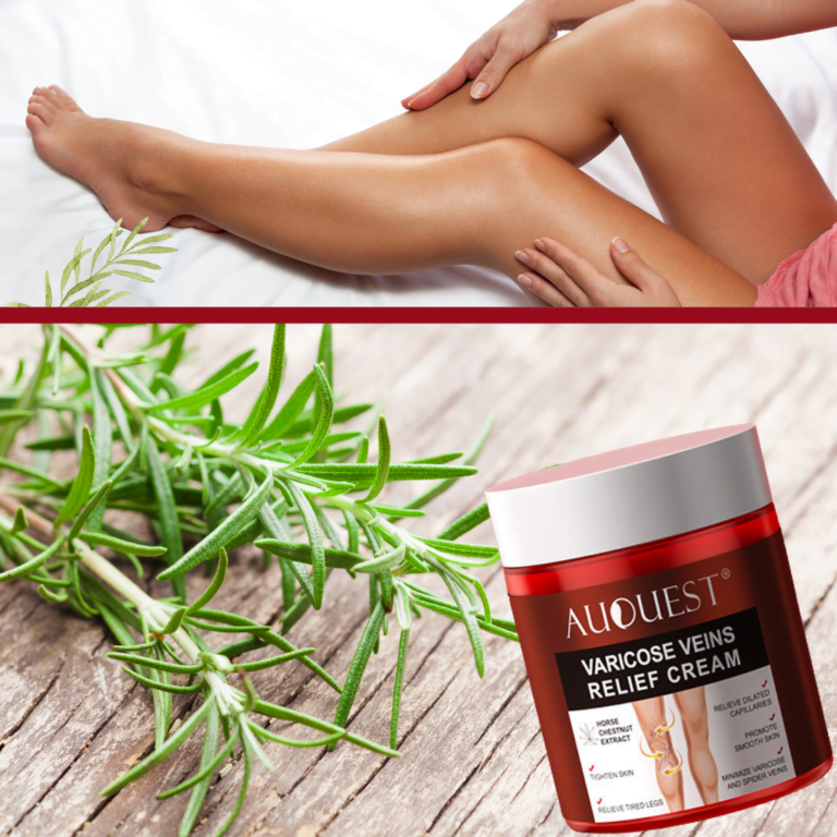 Varicose and Spider Veins Removal Cream- natural extracts