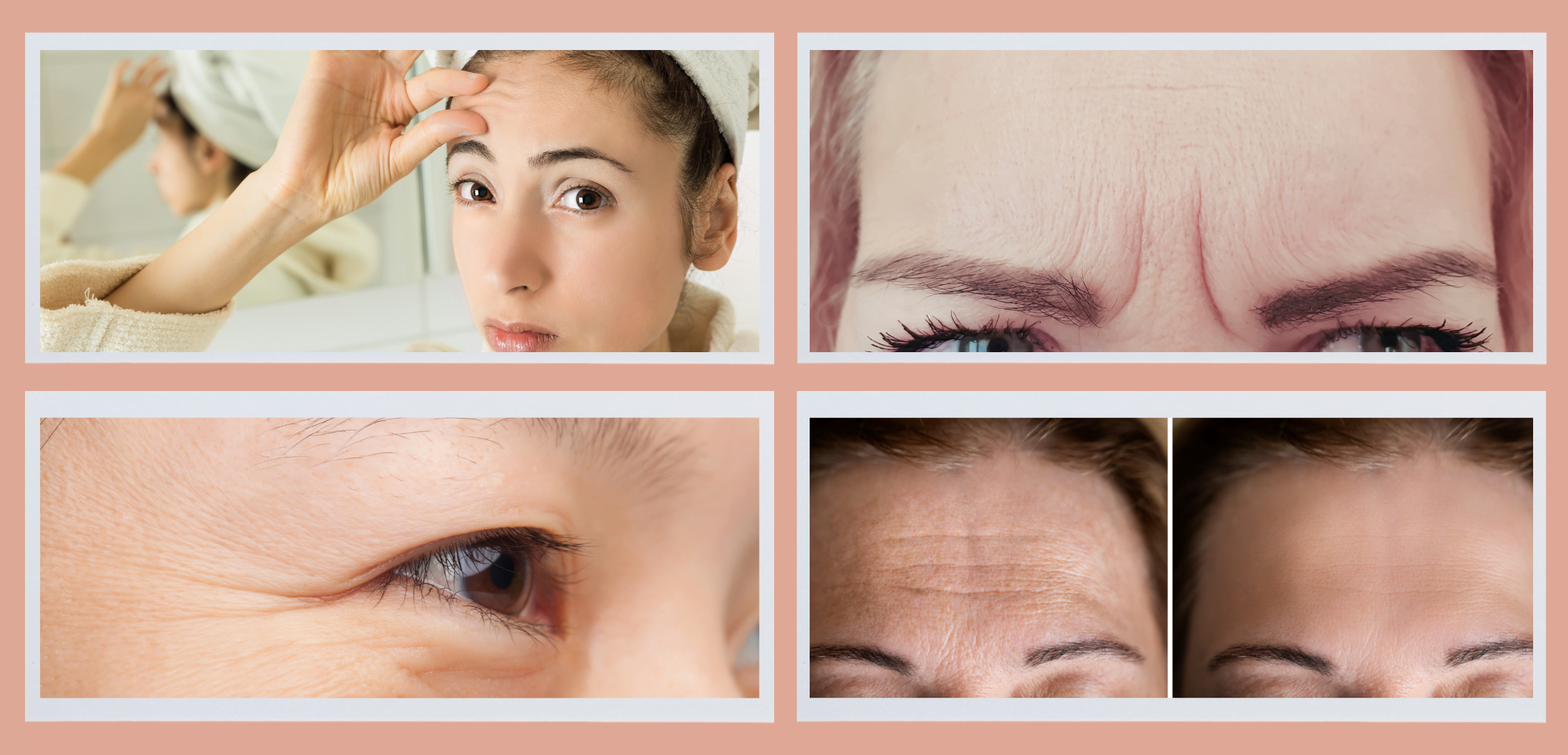 Instant Lift Anti-wrinkle Patches- get rid of frown lines, fine lines, wrinkles